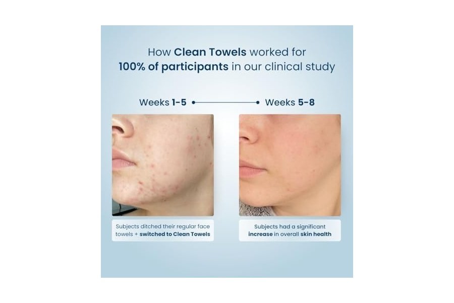 Clean Skin Club Clean Towels XL™, Toalla facial 100 % de origen biológico USDA, Toallita facial desechable, Aprobada por la Asociación para el Eccema, Toallitas secas desmaquillantes, Ultrasuaves, 200 unidades, Paquete de 4 - Image 8